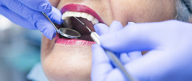 Best Emergency Treatment for Oral Infections in Cajahs Mountain, NC